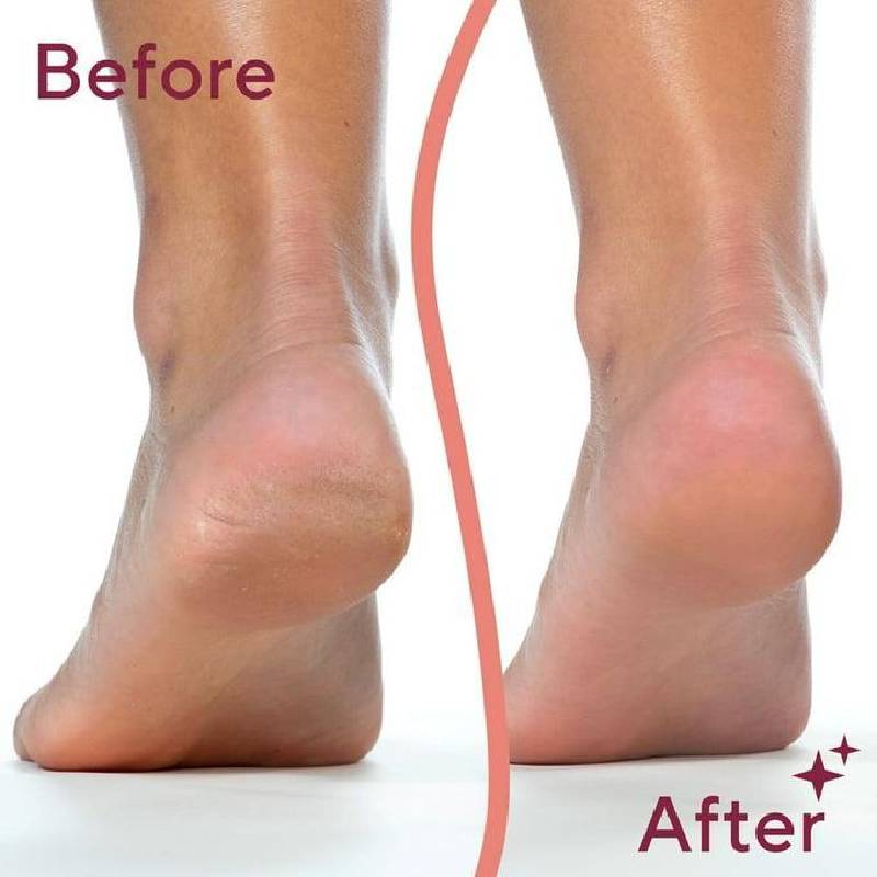 Outil de pédicure électronique rechargeable FLAWLESS – Image 2